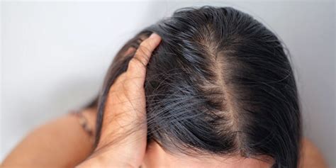 Tips Para sa Naglalagas na Buhok ng mga Bagong .